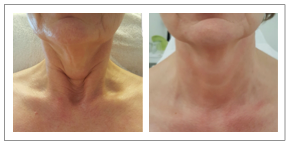 Schermafbeelding-2016-08-02-om-16.43.07